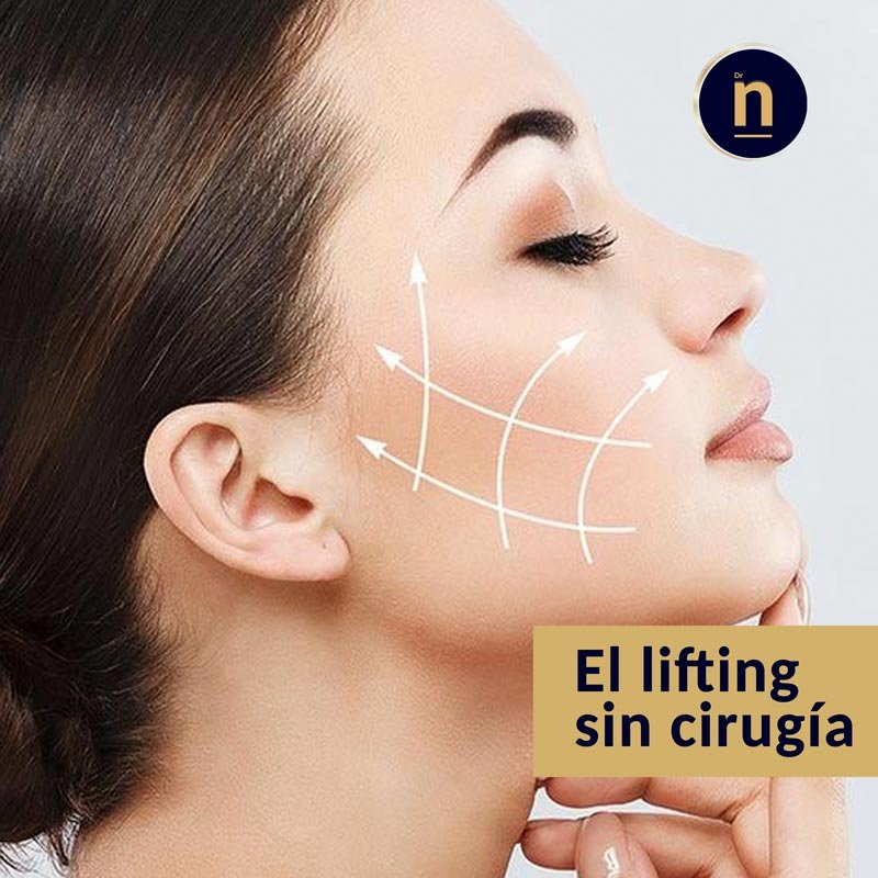 Inductores de colágeno, el lifting sin cirugía.