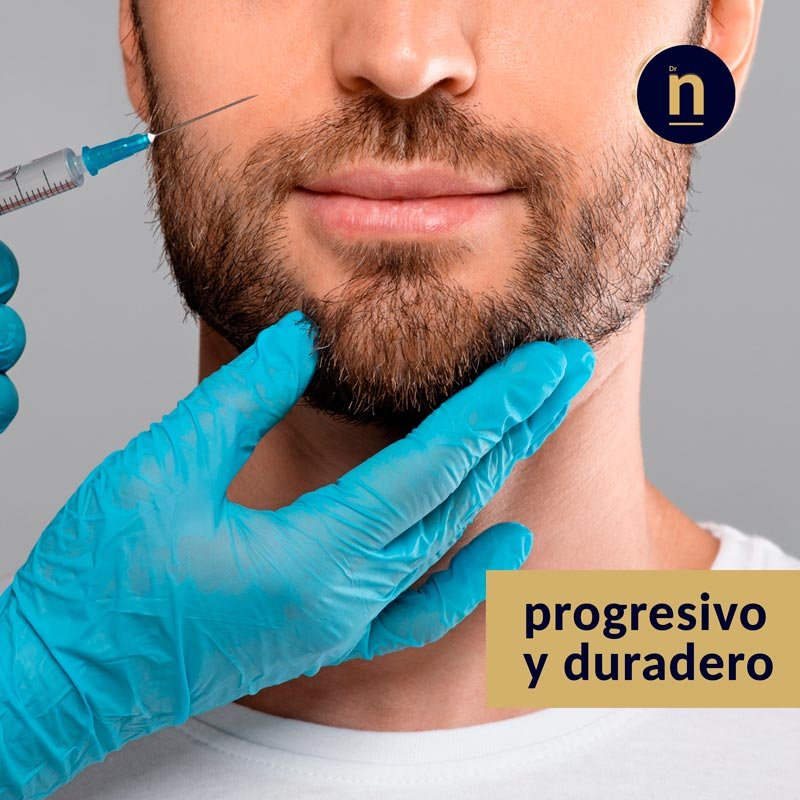 Surcos nasogenianos: tratamiento estético facial con ácido hialurónico.